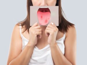 mulher com imagem de lingua com Mucosite Oral