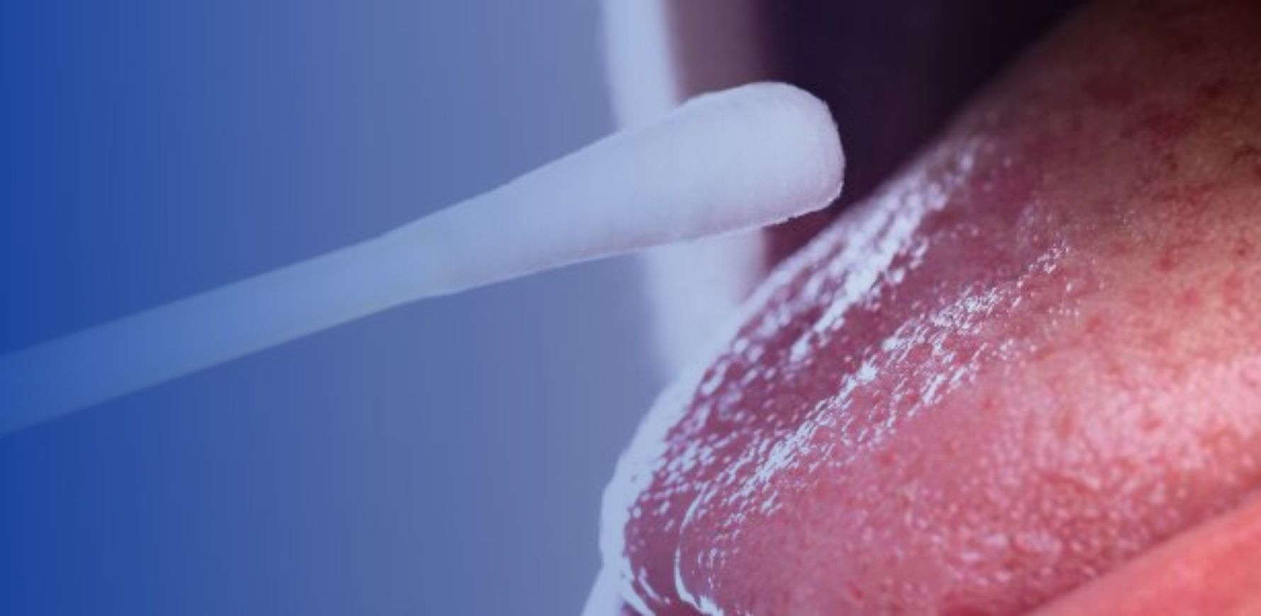 cotonete para exame de saliva