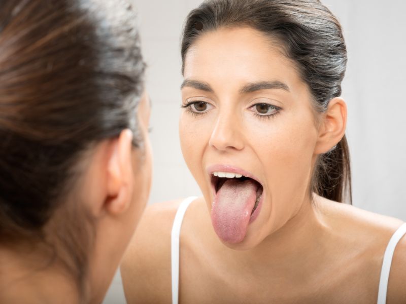 mulher mostrando a lingua com ardência bucal